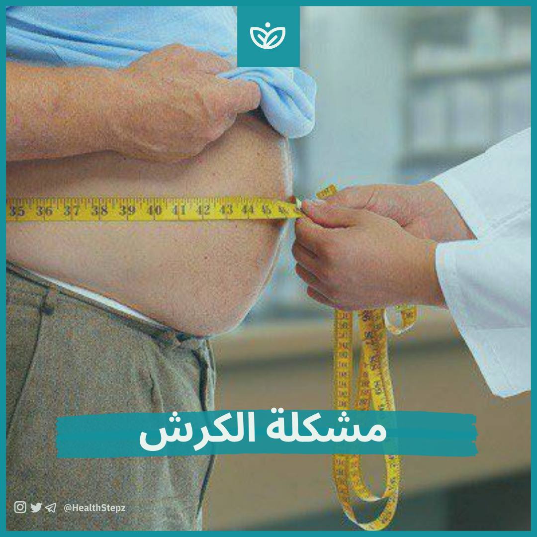 مشكلة الكرش البارزة